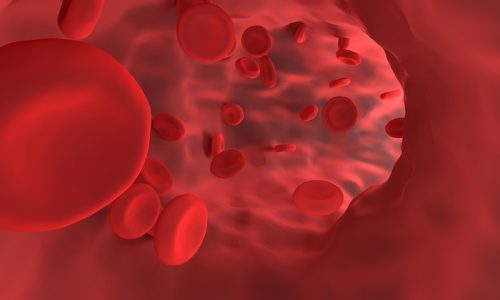Anemia red-blood-cell-4807218