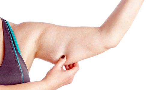 Middle-aged woman holding a hand with excess fat. On a white background.