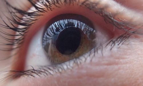 Glaucoma-eye-321961